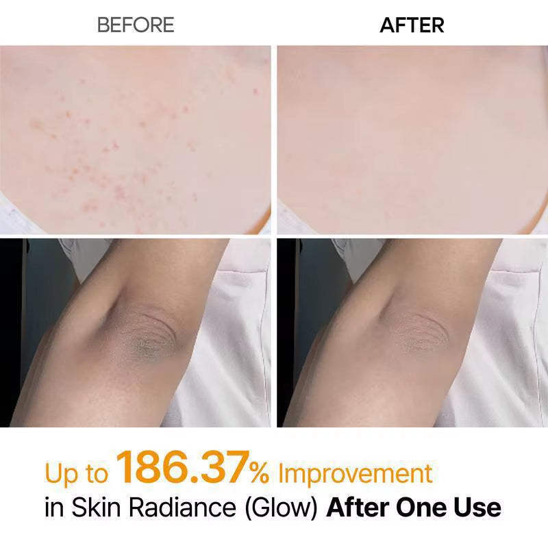 Kojic Acid Turmeric Body Scrub Spray: Deeply Cleanses and Moisturizes, Gently Removing Dead Skin Cells.
