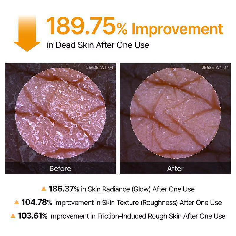 Kojic Acid Turmeric Body Scrub Spray: Deeply Cleanses and Moisturizes, Gently Removing Dead Skin Cells.