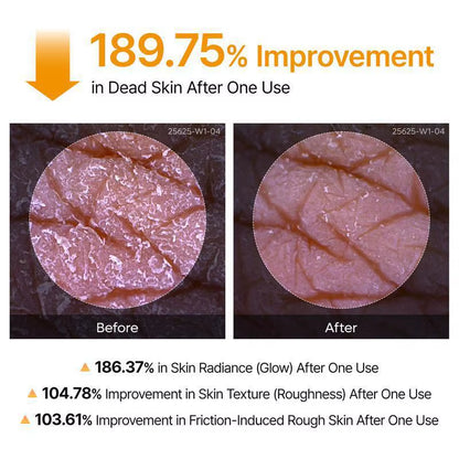 Kojic Acid Turmeric Body Scrub Spray: Deeply Cleanses and Moisturizes, Gently Removing Dead Skin Cells.